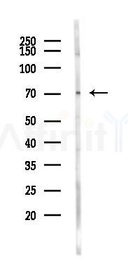 HSP70 Mouse Monoclonal Antibody - Western blot analysis of lysates from K562 cells(UV 30min treatment), using HSP70 Mouse Monoclonal Antibody at 1/1000 dilution.
