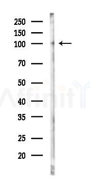 eEF2K Mouse Monoclonal Antibody - Western blot analysis of lysates from Mouse lung, using eEF2K Mouse Monoclonal Antibody at 1/1000 dilution.