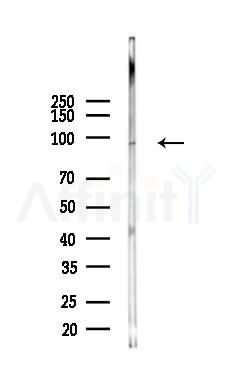TLR5 Mouse Monoclonal Antibody - Western blot analysis of lysates from K562 cells(LPS 4h treatment), using TLR5 Mouse Monoclonal Antibody at 1/1000 dilution.