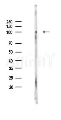 KSR2 Mouse Monoclonal Antibody - Western blot analysis of lysates from HUVEC cells(UV 30min treatment), using KSR2 Mouse Monoclonal Antibody at 1/1000 dilution.
