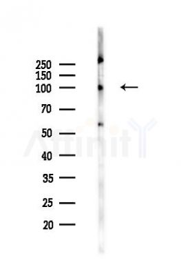 Phospho-STAT5 (Ser725/Ser730)[Ser726/Ser731] Mouse Monoclonal Antibody - Western blot analysis of lysates from HUVEC cells(UV 30min treatment), using Phospho-STAT5 (Ser725/Ser730)[Ser726/Ser731] Mouse Monoclonal Antibody at 1/1000 dilution.