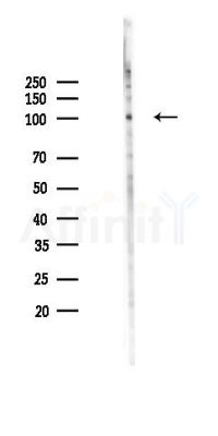 MCM2 Mouse Monoclonal Antibody - Western blot analysis of lysates from HUVEC cells(UV 30min treatment), using MCM2 Mouse Monoclonal Antibody at 1/1000 dilution.