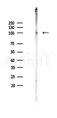 Hexokinase 1 Mouse Monoclonal Antibody - Western blot analysis of lysates from HUVEC cells(UV 30min treatment), using Hexokinase 1 Mouse Monoclonal Antibody at 1/1000 dilution.