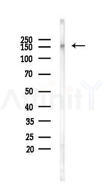 Nestin Mouse Monoclonal Antibody - Western blot analysis of lysates from Rat muscle, using Nestin Mouse Monoclonal Antibody at 1/1000 dilution.