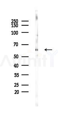 Cytokeratin 16 Mouse Monoclonal Antibody - Western blot analysis of lysates from Mouse testis, using Cytokeratin 16 Mouse Monoclonal Antibody at 1/1000 dilution.