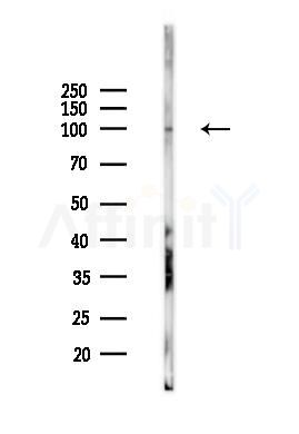 PEG10 Mouse Monoclonal Antibody - Western blot analysis of lysates from HUVEC cells(UV 30min treatment), using PEG10 Mouse Monoclonal Antibody at 1/1000 dilution.