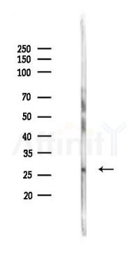 NET-5 Mouse Monoclonal Antibody - Western blot analysis of lysates from HUVEC cells(UV 30min treatment), using NET-5 Mouse Monoclonal Antibody at 1/1000 dilution.