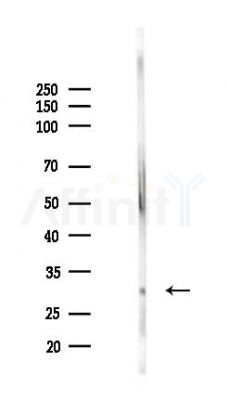 DCXR Mouse Monoclonal Antibody - Western blot analysis of lysates from Mouse lung, using DCXR Mouse Monoclonal Antibody at 1/1000 dilution.