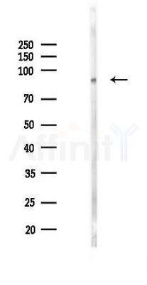 COPG Mouse Monoclonal Antibody - Western blot analysis of lysates from Mouse lung, using COPG Mouse Monoclonal Antibody at 1/1000 dilution.