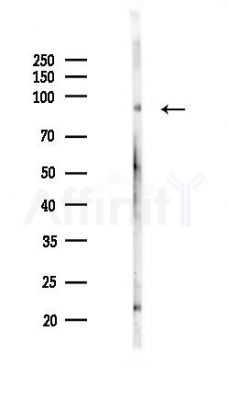 SCML2 Mouse Monoclonal Antibody - Western blot analysis of lysates from Mouse lung, using SCML2 Mouse Monoclonal Antibody at 1/1000 dilution.
