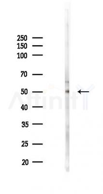 MRS2 Mouse Monoclonal Antibody - Western blot analysis of lysates from Mouse lung, using MRS2 Mouse Monoclonal Antibody at 1/1000 dilution.
