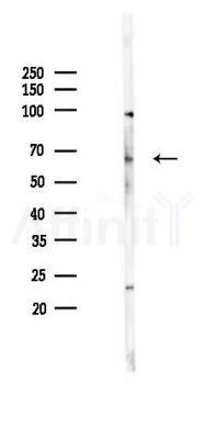 PLCZ1 Mouse Monoclonal Antibody - Western blot analysis of lysates from HUVEC cells(UV 30min treatment), using PLCZ1 Mouse Monoclonal Antibody at 1/1000 dilution.