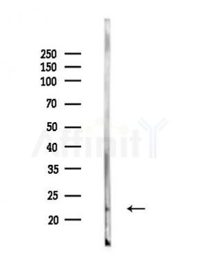NMNAT3 Mouse Monoclonal Antibody - Western blot analysis of lysates from 293 cells(UV 30min treatment), using NMNAT3 Mouse Monoclonal Antibody at 1/1000 dilution.