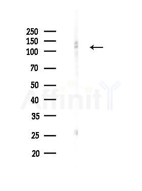 ASAH2 Mouse Monoclonal Antibody - Western blot analysis of lysates from 293 cells(UV 30min treatment), using ASAH2 Mouse Monoclonal Antibody at 1/1000 dilution.
