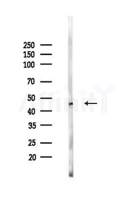 Annexin VII Mouse Monoclonal Antibody - Western blot analysis of lysates from Mouse lung, using Annexin VII Mouse Monoclonal Antibody at 1/1000 dilution.