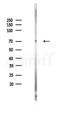 Rabphilin 3A Mouse Monoclonal Antibody - Western blot analysis of lysates from HUVEC cells(UV 30min treatment), using Rabphilin 3A Mouse Monoclonal Antibody at 1/1000 dilution.