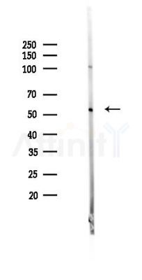 EFEMP2 Mouse Monoclonal Antibody - Western blot analysis of lysates from HUVEC cells(UV 30min treatment), using EFEMP2 Mouse Monoclonal Antibody at 1/1000 dilution.