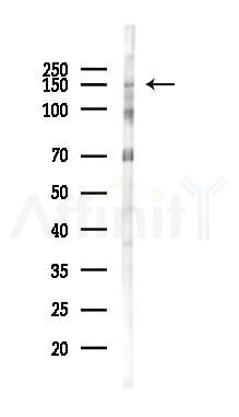 LTBP1 Antibody - Western blot analysis of lysates from Rat heart, using LTBP1 Antibody at 1/1000 dilution.