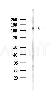 FGFR1/2 Antibody - Western blot analysis of lysates from 293 cells(UV 31min treatment), using FGFR1/2 Antibody at 1/1000 dilution.