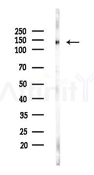 FGFR1/2 Antibody - Western blot analysis of lysates from HUVEC cells(UV 31min treatment), using FGFR1/2 Antibody at 1/1000 dilution.