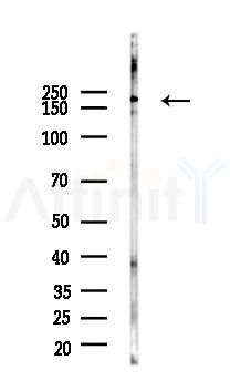 KIDINS220 Antibody - Western blot analysis of lysates from HUVEC cells(UV 30min treatment), using KIDINS220 Antibody at 1/1000 dilution.
