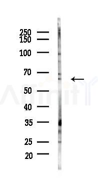 PIP5K1A Antibody - Western blot analysis of lysates from HUVEC cells(UV 30min treatment), using PIP5K1A Antibody at 1/1000 dilution.
