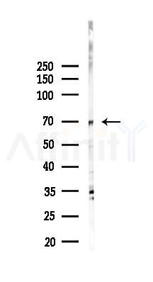 ASUN Antibody - Western blot analysis of lysates from Mouse testis, using ASUN Antibody at 1/1000 dilution.