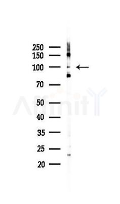 BBX Antibody - Western blot analysis of lysates from 293 cells(UV 30min treatment), using BBX Antibody at 1/1000 dilution.