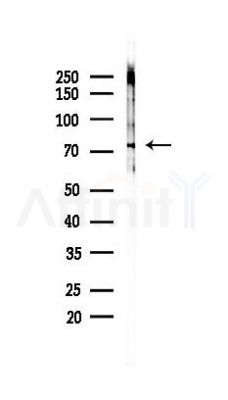 RLIM Antibody - Western blot analysis of lysates from HUVEC cells(UV 30min treatment), using RLIM Antibody at 1/1000 dilution.