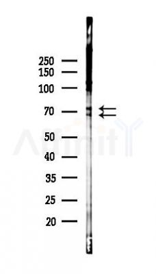 SLC38A1 Antibody - Western blot analysis of lysates from 293 cells(UV 30min treatment), using SLC38A1 Antibody at 1/1000 dilution.