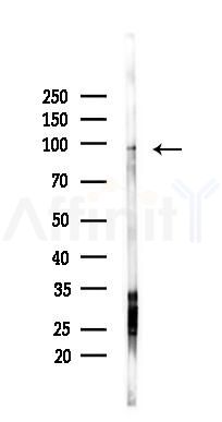 IPO13 Antibody - Western blot analysis of lysates from PC12 cells(starvation 24h treatment), using IPO13 Antibody at 1/1000 dilution.