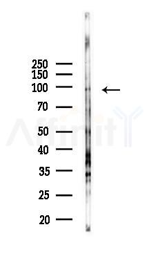 MARS Antibody - Western blot analysis of lysates from K562 cells(UV 30min treatment), using MARS Antibody at 1/1000 dilution.