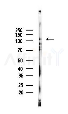 MTUS1 Antibody - Western blot analysis of lysates from K562 cells(UV 30min treatment), using MTUS1 Antibody at 1/1000 dilution.