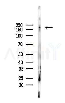 MYOM1 Antibody - Western blot analysis of lysates from K562 cells(UV 30min treatment), using MYOM1 Antibody at 1/1000 dilution.