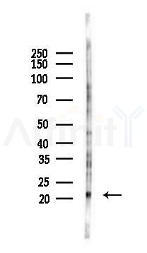 NUDT16 Antibody - Western blot analysis of lysates from K562 cells(UV 30min treatment), using NUDT16 Antibody at 1/1000 dilution.