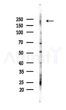 Fast Myosin Skeletal Heavy chain Antibody - Western blot analysis of lysates from PC12 cells(starvation 24h treatment), using Fast Myosin Skeletal Heavy chain Antibody at 1/1000 dilution.