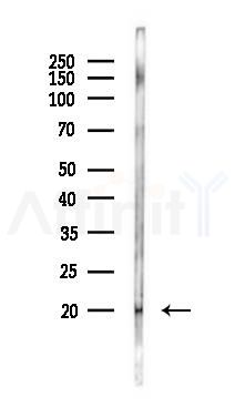 Lymphocyte Antigen 6 Complex Antibody - Western blot analysis of lysates from Rat testis, using Lymphocyte Antigen 6 Complex Antibody at 1/1000 dilution.