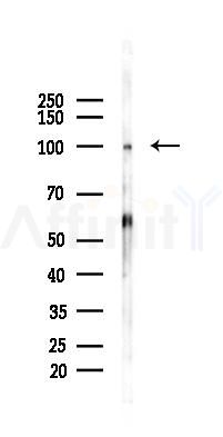SV2A Antibody - Western blot analysis of lysates from Rat brain, using SV2A Antibody at 1/1000 dilution.