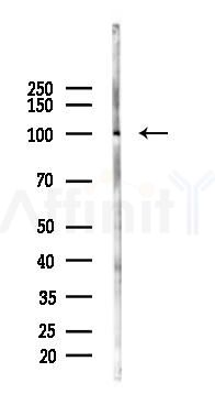 RNF31/HOIP Antibody - Western blot analysis of lysates from Rat brain, using RNF31/HOIP Antibody at 1/1000 dilution.