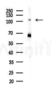 alpha 1 Spectrin Antibody - Western blot analysis of lysates from Mouse heart, using alpha 1 Spectrin Antibody at 1/1000 dilution.