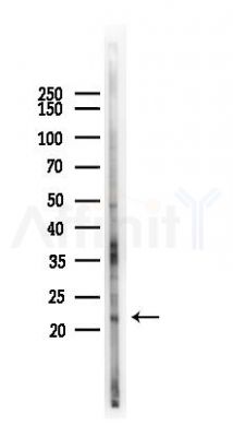 C9orf142 Antibody - Western blot analysis of lysates from HUVEC cells(UV 30min treatment), using C9orf142 Antibody at 1/1000 dilution.