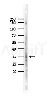 HOXA4 Antibody - Western blot analysis of lysates from HUVEC cells(UV 30min treatment), using HOXA4 Antibody at 1/1000 dilution.