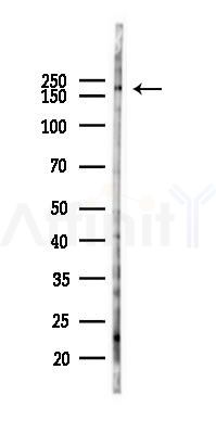 TEX14 Antibody - Western blot analysis of lysates from 293 cells(UV 30min treatment), using TEX14 Antibody at 1/1000 dilution.