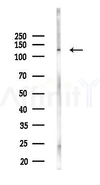 CC2D1A Antibody - Western blot analysis of lysates from 293 cells(LPS 4h treatment), using CC2D1A Antibody at 1/1000 dilution.