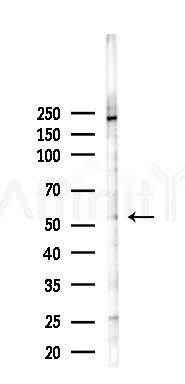 PFKFB2 Antibody - Western blot analysis of lysates from 293 cells(LPS 4h treatment), using PFKFB2 Antibody at 1/1000 dilution.