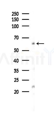 ER81 Antibody - Western blot analysis of lysates from Mouse heart, using ER81 Antibody at 1/1000 dilution.