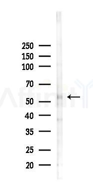 ZNF187 Antibody - Western blot analysis of lysates from 293 cells(LPS 4h treatment), using ZNF187 Antibody at 1/1000 dilution.