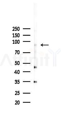 BRSK1 Antibody - Western blot analysis of lysates from 293 cells(LPS 4h treatment), using BRSK1 Antibody at 1/1000 dilution.