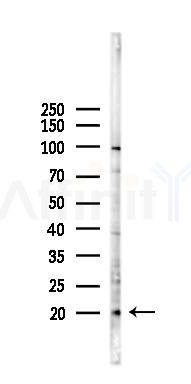 PBOV1 Antibody - Western blot analysis of lysates from HUVEC cells(LPS 4h treatment), using PBOV1 Antibody at 1/1000 dilution.