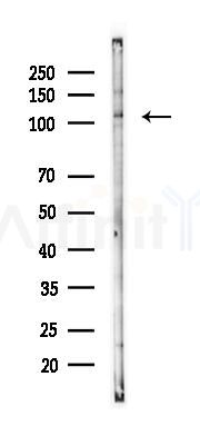 ZC3H7B Antibody - Western blot analysis of lysates from K562 cells(LPS 4h treatment), using ZC3H7B Antibody at 1/1000 dilution.